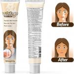 Jouyzan Vitiligo Cream – Natural Treatment to Improve Skin Pigmentation