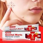 DouBX Hom Wart Remover Freeze Off – Wart Cream for Genital Warts