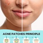 DClub Acne Patch – Overnight Hydrocolloid Spot Treatment