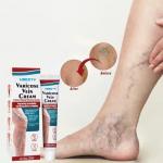Wholesale High Quality Vein Repair Cream – Leg Meridians & Vein Relaxation Gel