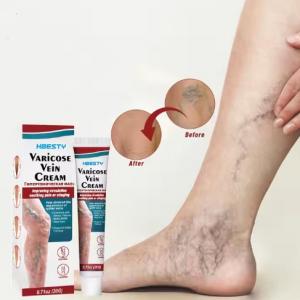 Wholesale High Quality Vein Repair Cream – Leg Meridians & Vein Relaxation Gel