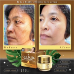 Gold 24K Whitening Cream Nourishing Skin – Acne, Freckles, Melasma – 15g
